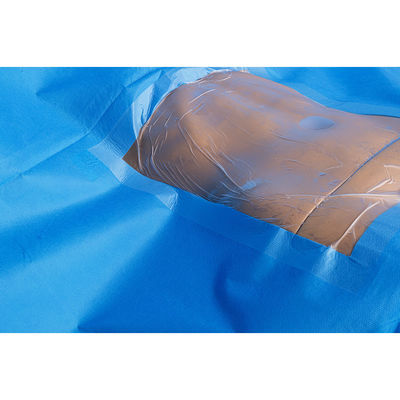 Steril Bedah C-Section Pack Set Cesarean Section Pack Bedah C-Section Drape Set