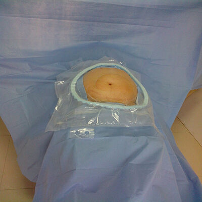 Paket bedah sekali pakai dengan zona kritis penyerap yang diperkuat dan sterilisasi EO untuk darurat rumah sakit